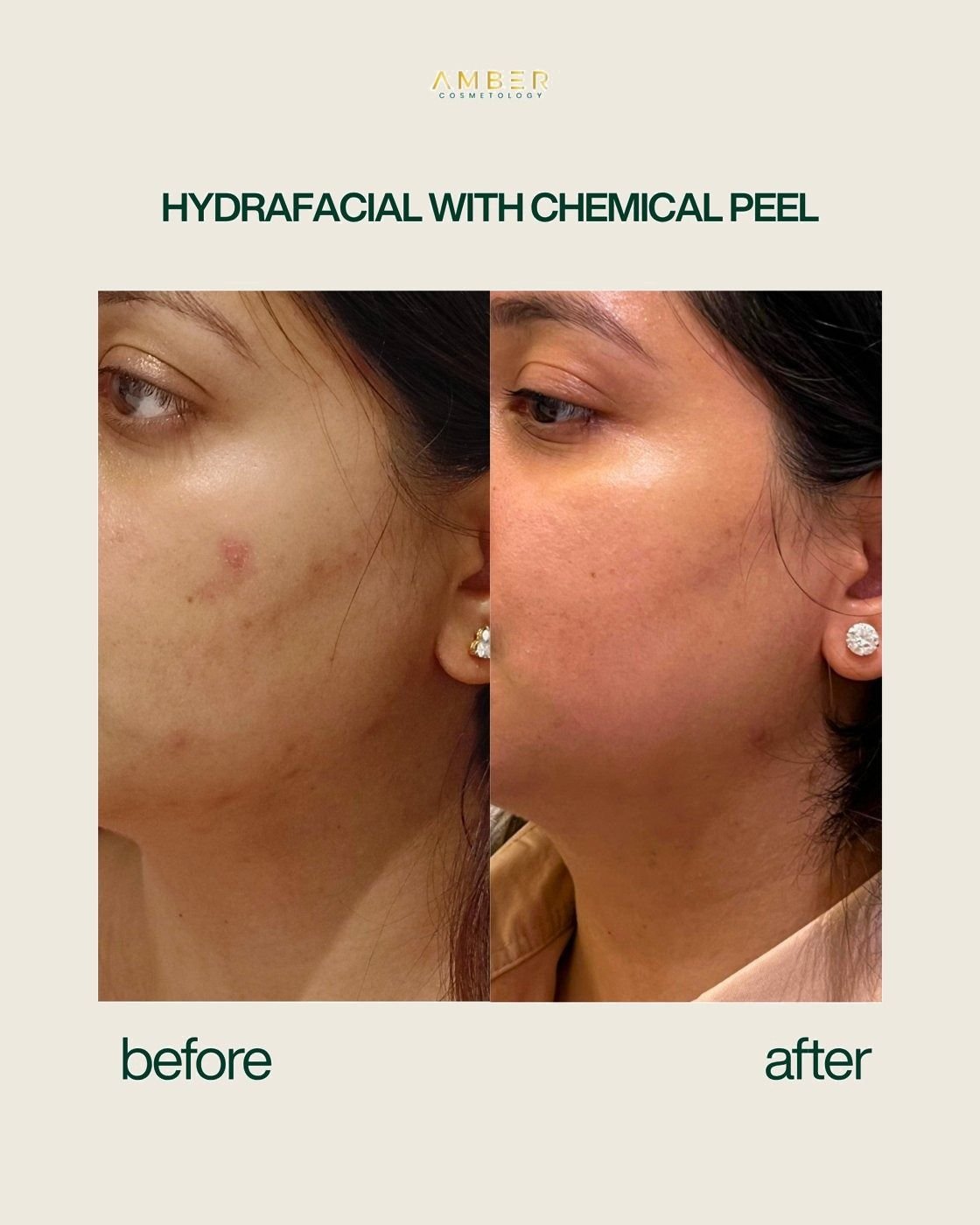 Before and after result at Amber Cosmetology, Lucknow