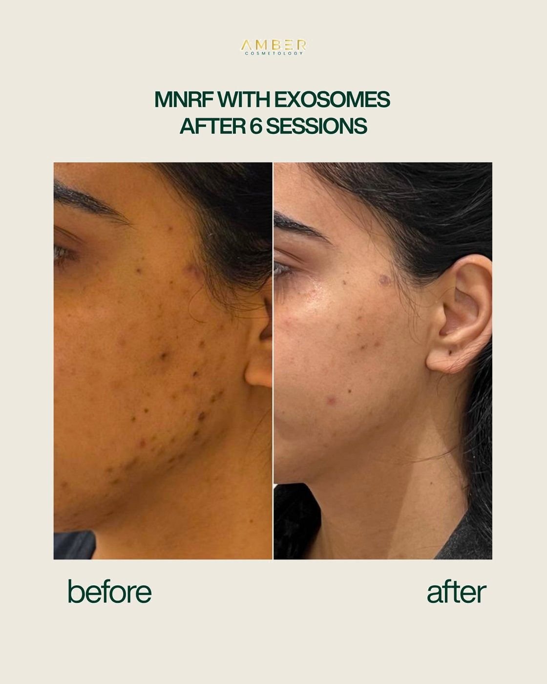Before and after result at Amber Cosmetology, Lucknow