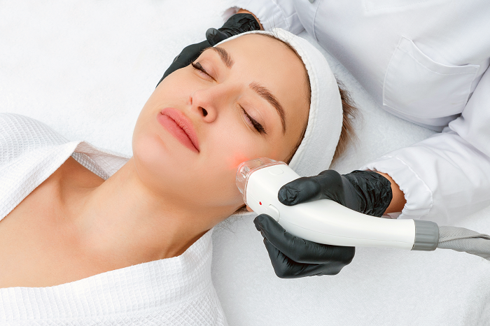 Laser Treatment for Hyperpigmentation – A Safe and Reliable Solution