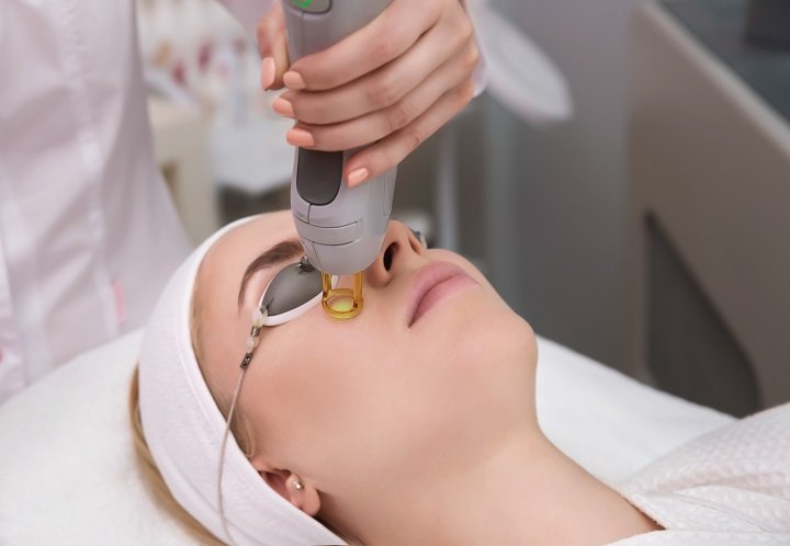 Myths and Facts About Laser Treatments in Lucknow