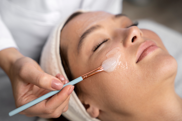 Is Chemical Peel Good for Skin?