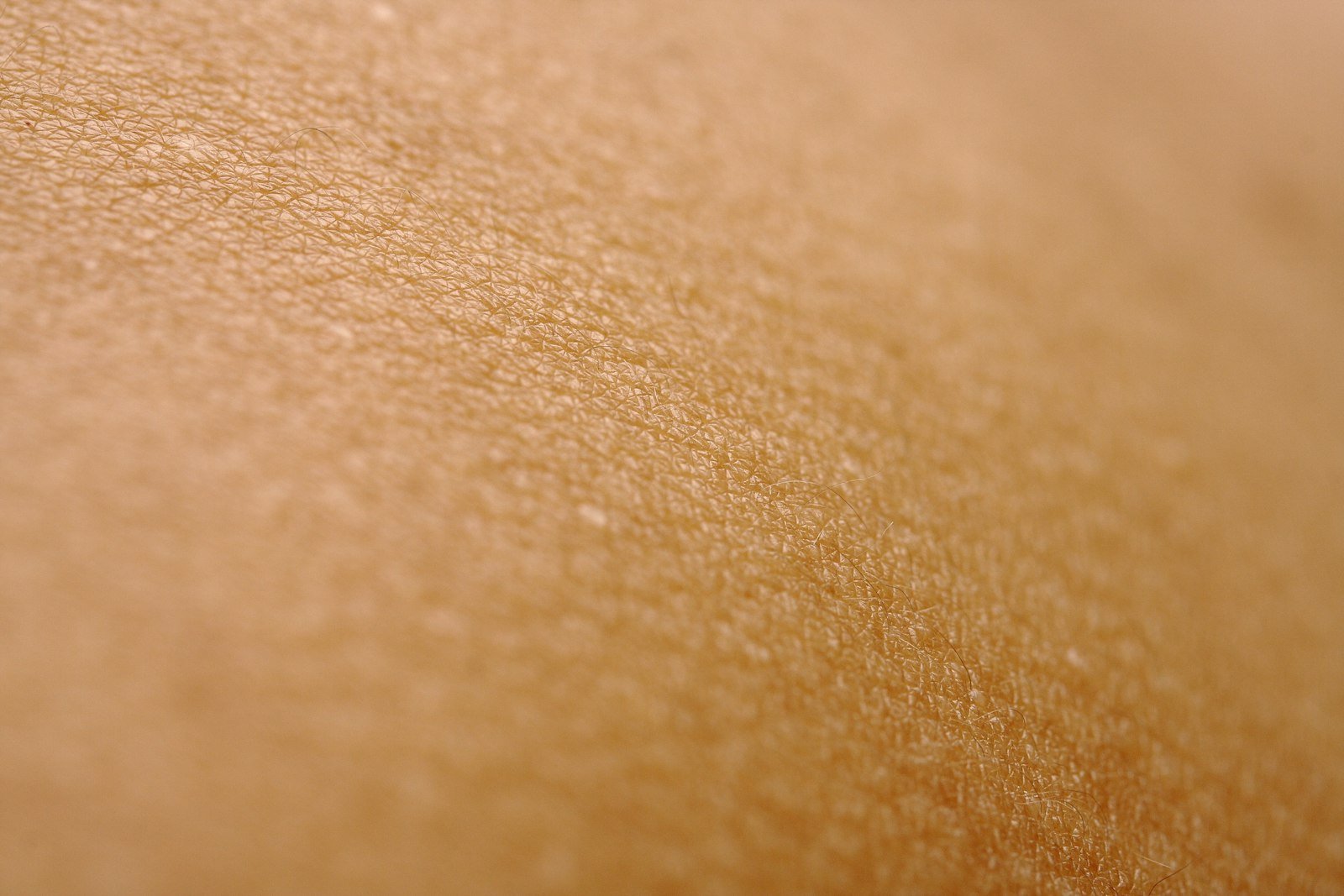 Acne Scar Treatment Cost in Lucknow: Scar Type Decides It